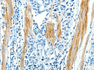 CAV3 Antibody