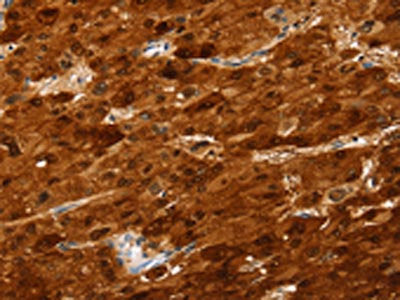 SULT2A1 Antibody