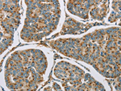 CYP11B1 Antibody