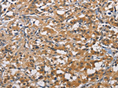 PIKFYVE Antibody