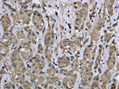 MYL12B Antibody
