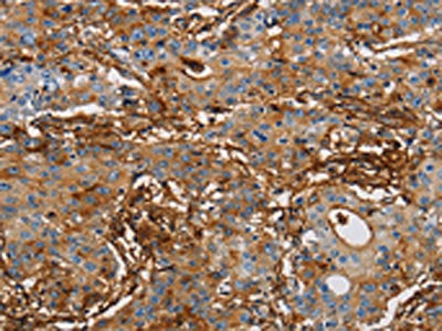 ICAM1 Antibody