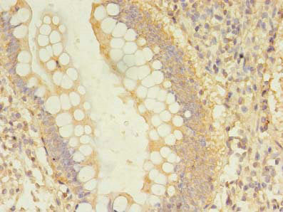 DCTN2 Antibody