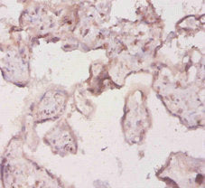 IL18 Antibody