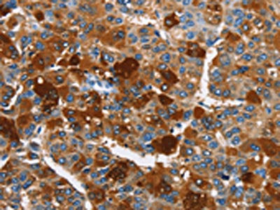 ARMCX2 Antibody