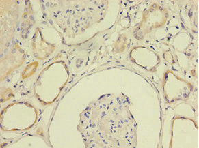 LY6E Antibody