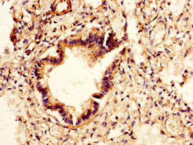 CHI3L2 Antibody
