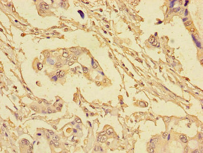 EIF4EBP1 Antibody