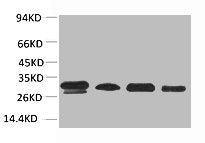 PRKAB2 Antibody
