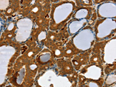 RAB27A Antibody