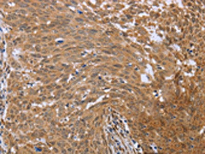 FHL2 Antibody