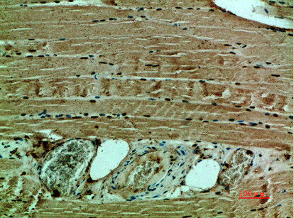 COL12A1 Antibody