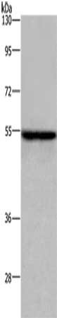 ETS2 Antibody