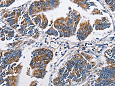 NPPA Antibody