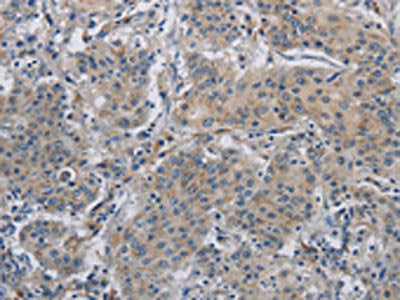 DNAJB4 Antibody