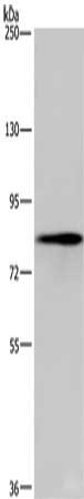 EEF2K Antibody