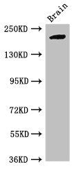 RBBP6 Antibody