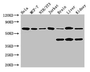 CARM1 Antibody