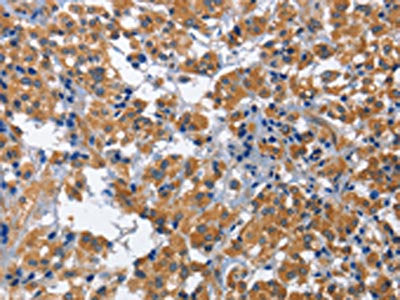 CDK5RAP3 Antibody