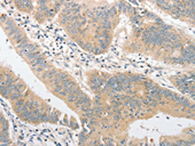 TLR4 Antibody