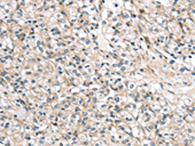 TMPRSS11B Antibody