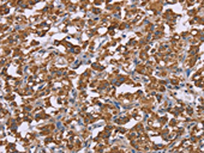 PPIF Antibody