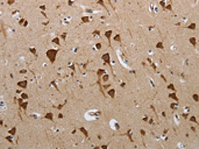 PMS2 Antibody