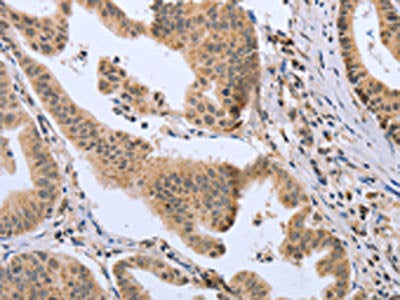 DLD Antibody