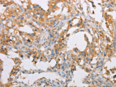 ACTR2 Antibody
