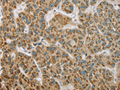 EHHADH Antibody
