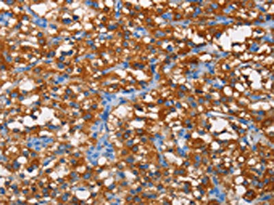 PFKP Antibody