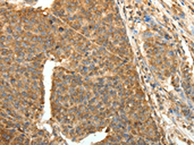 PTCH1 Antibody