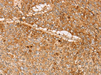 PACSIN2 Antibody