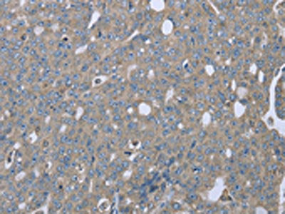 EZR Antibody