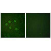 SAE1 Antibody