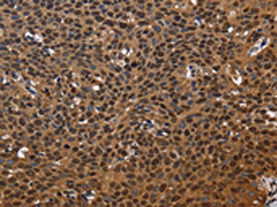 EXTL3 Antibody