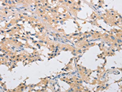 IKBKG Antibody