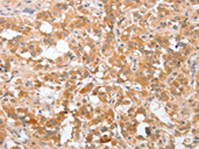PLA2G4A Antibody