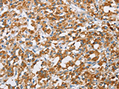 BDH1 Antibody