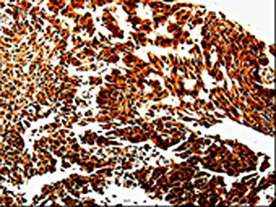 MMP13 Antibody