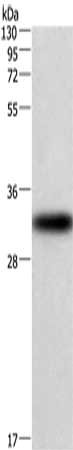 CENPP Antibody