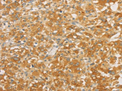 SPTLC1 Antibody