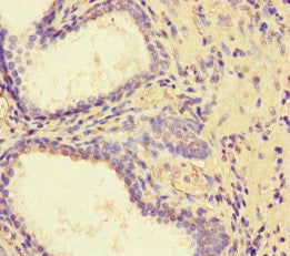 PDLIM5 Antibody