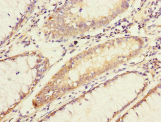 ADCY4 Antibody