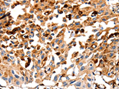 CTSB Antibody