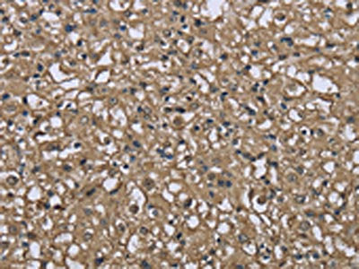 FBP1 Antibody