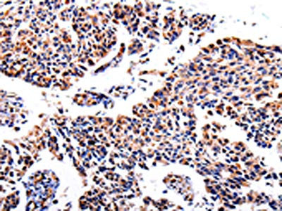 AKR1B1 Antibody