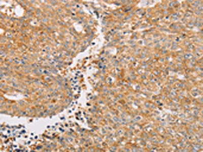 PACSIN2 Antibody