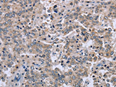 EID1 Antibody