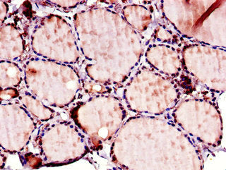 ACSF2 Antibody